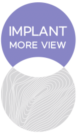 exquiller implant